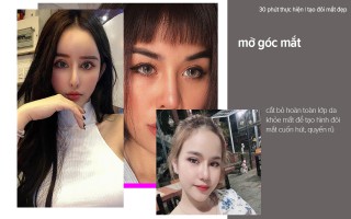 Chia sẻ của bác sĩ PTTM: phân biệt dịch vụ cắt mí mà mở góc mắt
